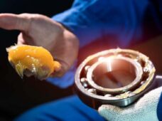 Manutenção: ainda uma fonte de preocupação e cuidado