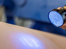 Nova manta de prensa reduz as paradas não planejadas e aumenta a eficiência de produção